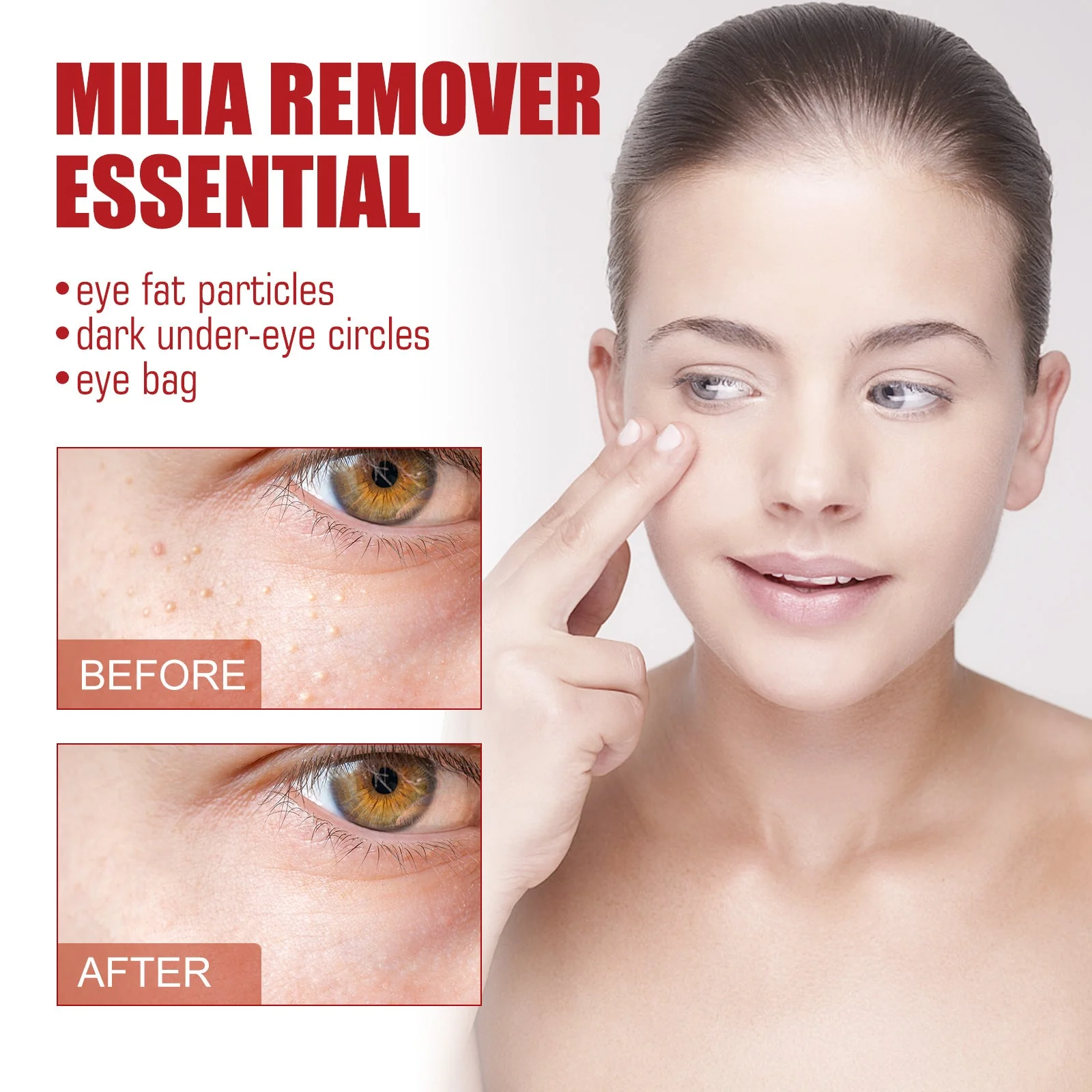 Milia Removal Eye Serum Dark Circles Fade fine lines Lifting Eye Serum